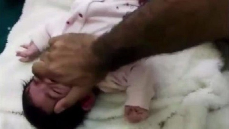 سعودي يعذب طفلته الرضيعة بوحشية