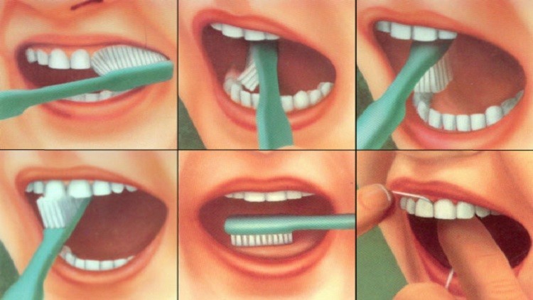 أطباء ينصحون بقلة تنظيف الأسنان