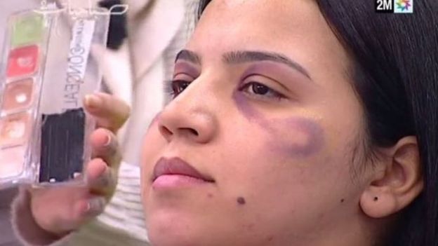 قناة مغربية تعتذر عن "تعليم النساء كيفية إخفاء آثار العنف المنزلي"