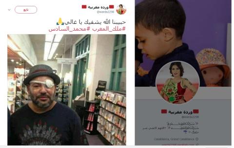 مغاربة يتمنون لملكهم الشفاء بعد أول صورة لعينه المصابة 